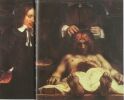 Рембрандт. Урок анатомии доктора Деймана. 1656