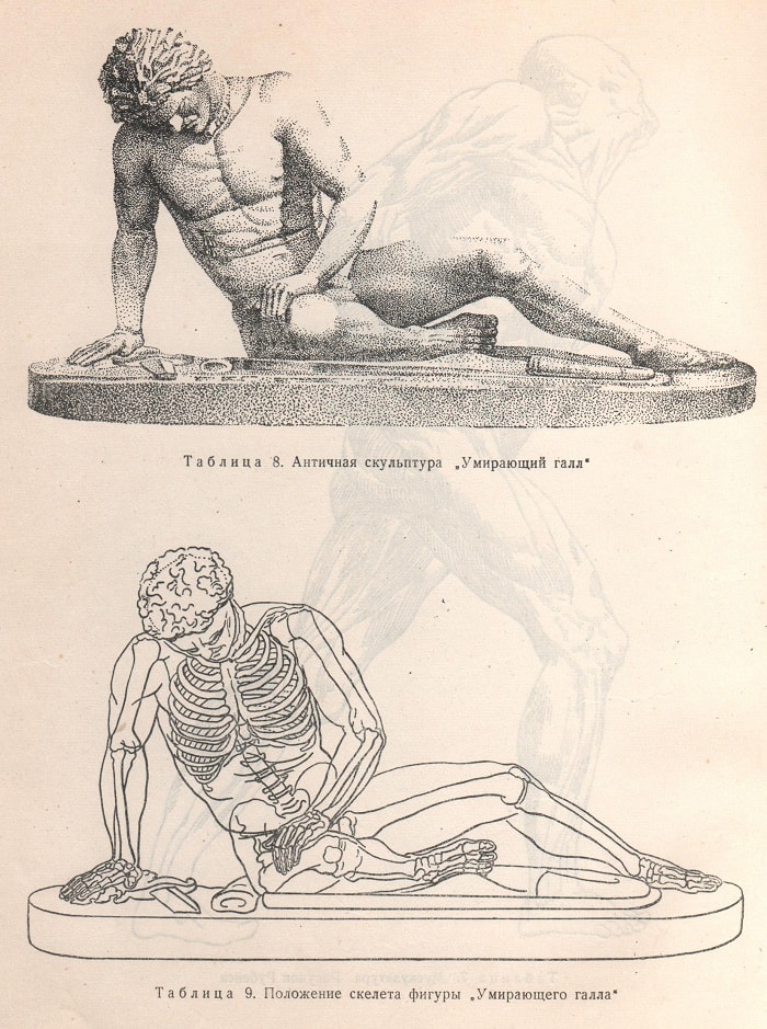 Положение скелета фигуры "Умирающего галла".